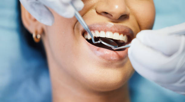 Best Emergency Dental Extractions in Limon, CO